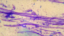 Bacterial (staph) infections (tiny purple dots pictured above) are very common secondary to allergies and various other skin conditions.